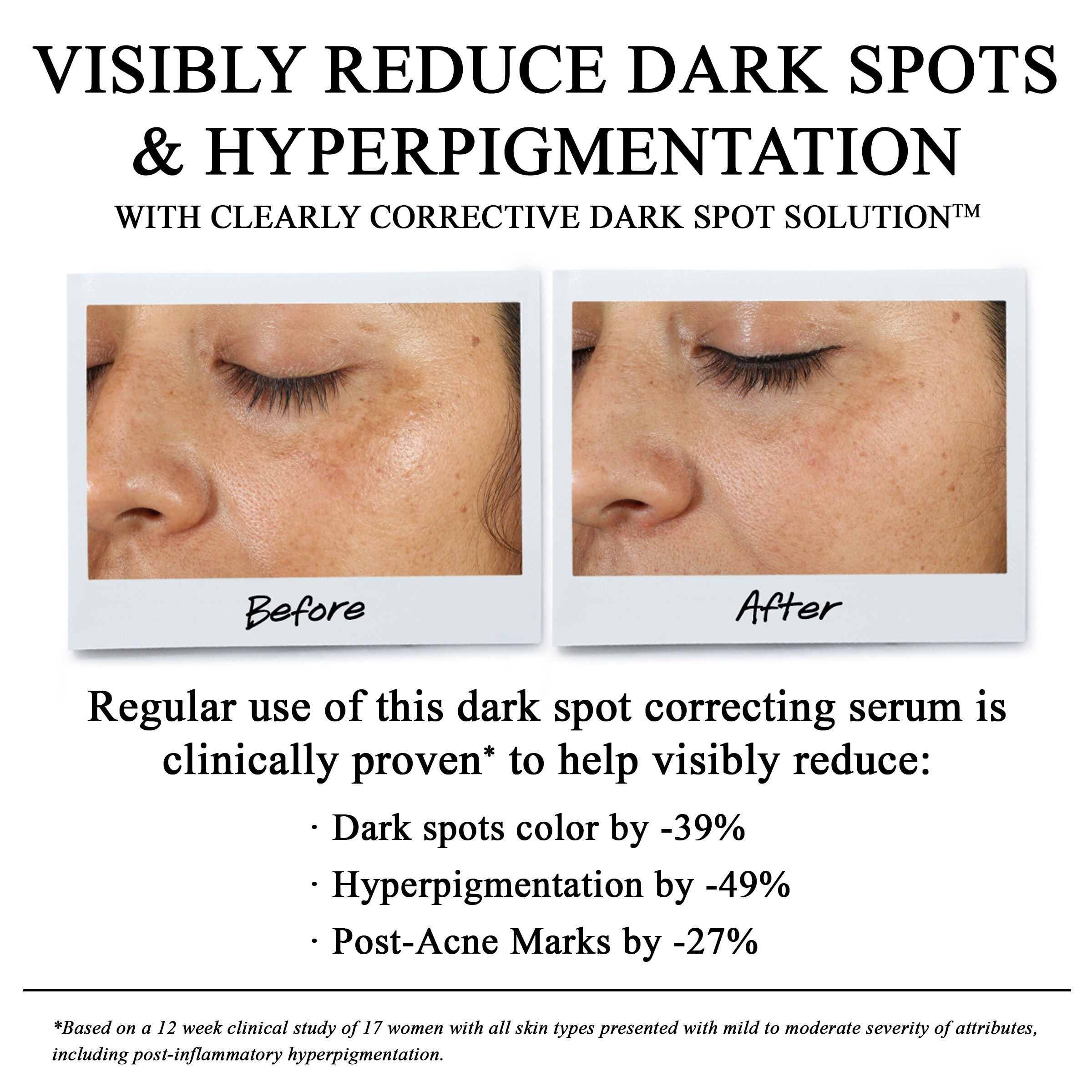 Clearly Corrective Dark Spot Solution to brighten skin Tone